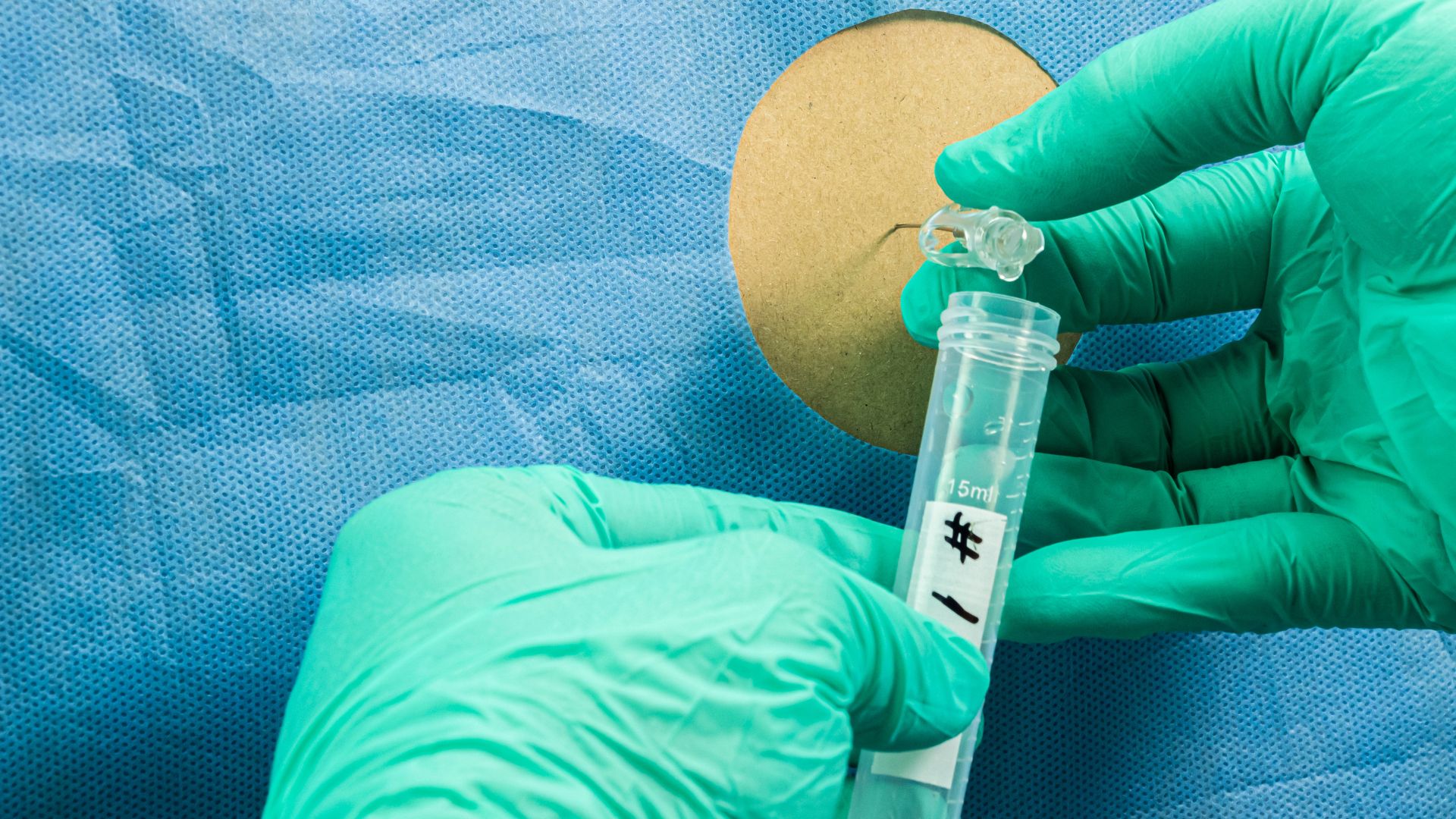 Mengenal Prosedur Aspirasi dan Biopsi Sumsum Tulang Belakang